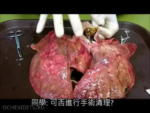 Китайский эксперимент про влияние сигарет на легкие